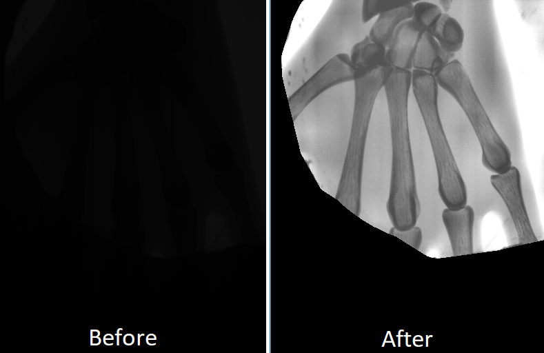 xray-before-after.png